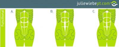 Normal Diastasis